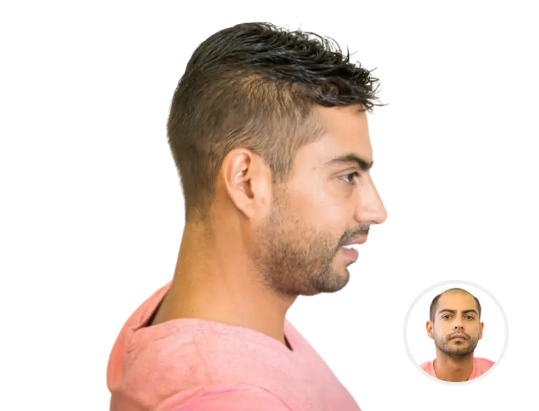 Client Transformation