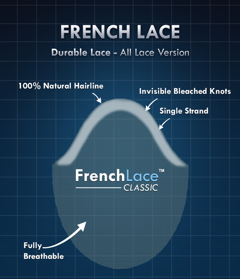 /assets/images/pages/french-lace-page/sliders/all-lace/webp/all-lace-1.webp
