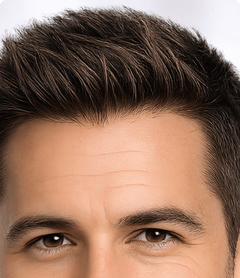 /assets/images/pages/hd-invisible-skin-page/sliders/thinnest/webp/hd-thinnest-skin-3.webp