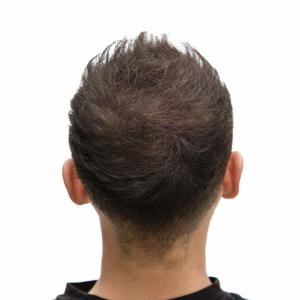 custom hair systems for men