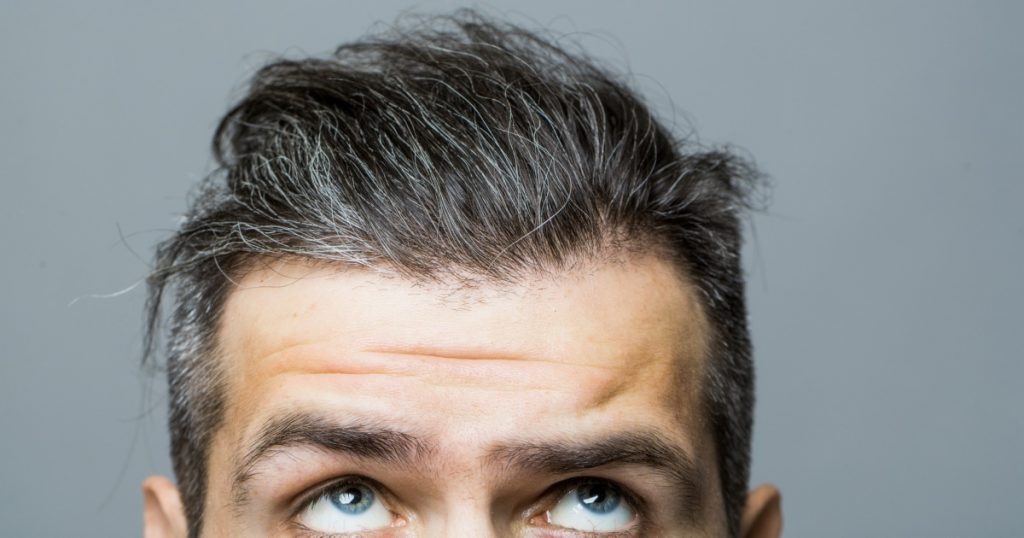 best hairpieces for thinning crown