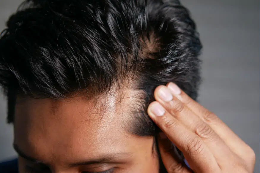 hair system