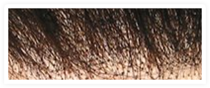 Hairline Img 1